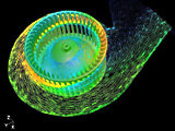 Air flow in ventilator case